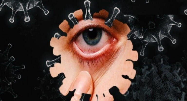 यूपी में फिर मिला ब्लैक फंगस: कानपुर में रोगी हैलट अस्पताल में भर्ती, तीसरी लहर में सामने आया पहला मामला