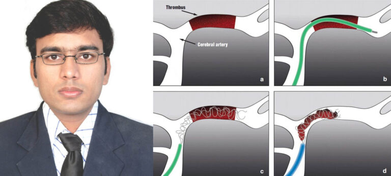 सर जेजे अस्पताल, मुंबई में इंटरवेंशनल रेडियोलॉजी के प्रोफेसर और यूनिट हेड डॉ. शिवराज इंगोले से ‘छत्तीसगढ़ रिपोर्टर’ का विशेष बातचीत
