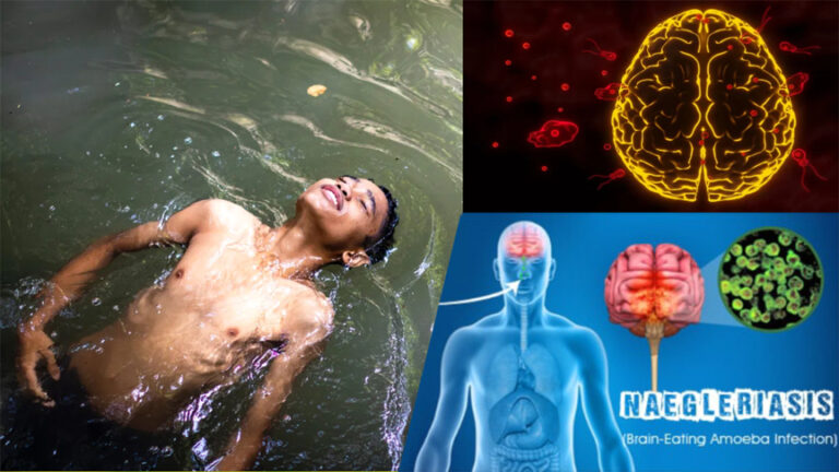 देश के इस राज्य में तेजी से बढ़ रहा ‘दिमाग खाने वाले अमीबा’ का खौफ, एक और व्यक्ति की मौत
