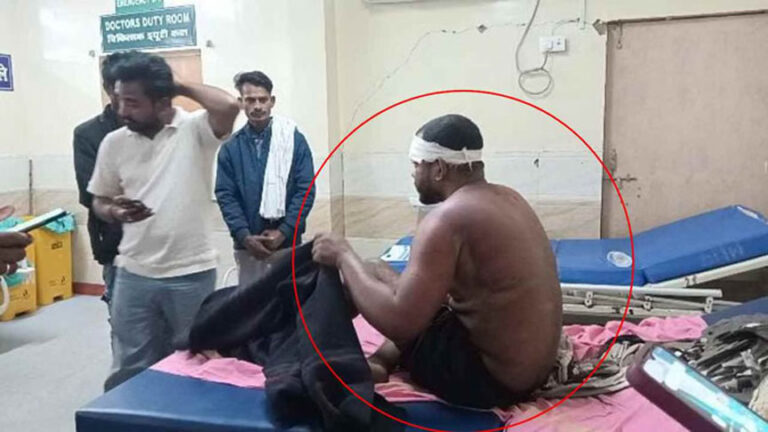 लूट की रूह कंपा देने वाली वारदात: मृत समझकर छोड़ भागे बदमाश, लाठी, डंडे और बेल्ट से अधमरा होने तक पीटा