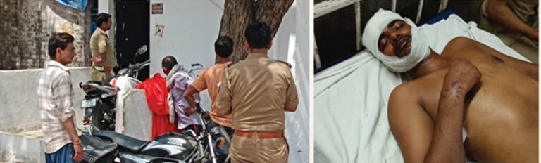 नौटंकी में पुलिस पर पथराव, PAC सिपाही को कुल्हाड़ी से काटा; जिसे जहां मिली जगह वहीं बचाई जान; भीड़ बनी ढाल